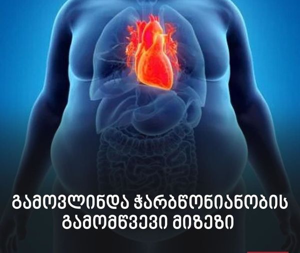 ჭარბწონიანობის მიზეზი გამოავლინეს – მასშტაბური კვლევის მიგნებები